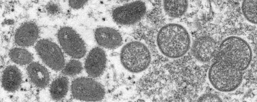 Monkeypox Monkeypox